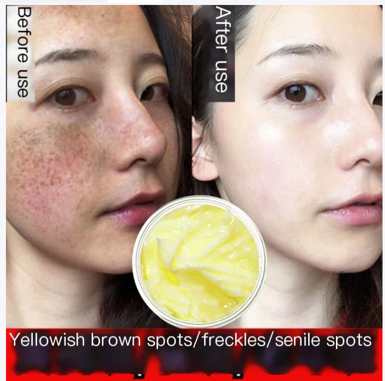 Astragalus Radiance Cream for Spot Reduction