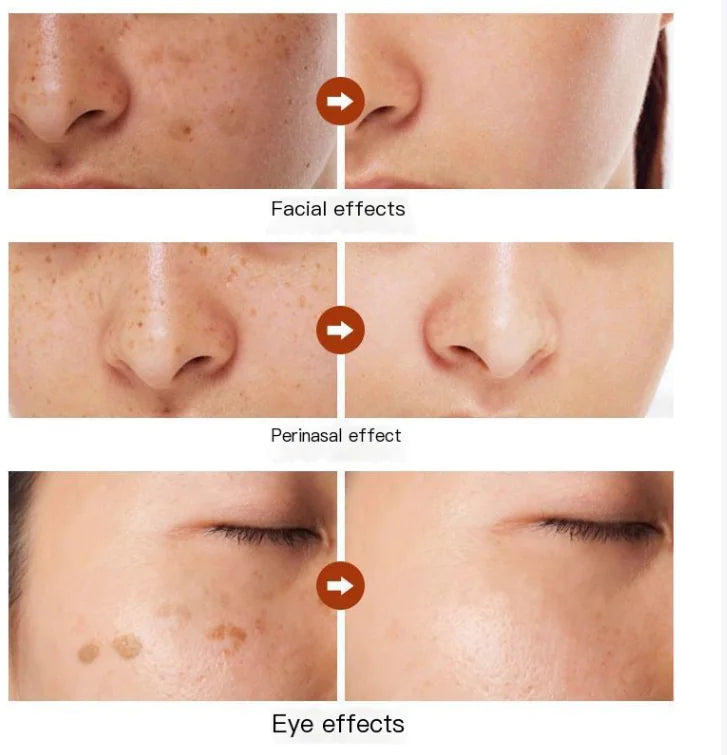 Astragalus Radiance Cream for Spot Reduction